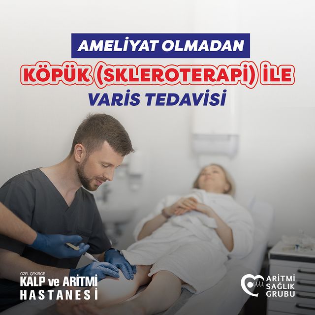 Varis Tedavisinde Ameliyatsız Yöntem: Köpüklü Varis Tedavisi