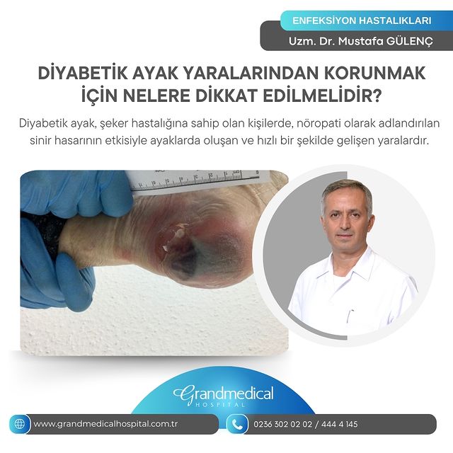 Diyabet ve Arterosklerozda Ayak Bakımına Dikkat!